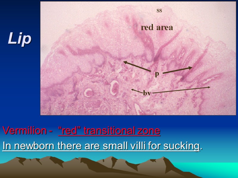 Lip Vermilion -  “red” transitional zone  In newborn there are small villi